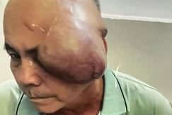 Mở rộng lòng từ: Ung thư tái phát không tiền điều trị