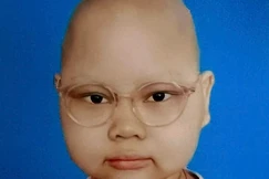 Mở rộng lòng từ: Nhà nghèo bị bệnh ung thư não