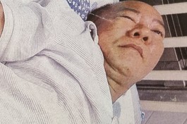 Mở rộng lòng từ: Bệnh viêm đa khớp nằm một chỗ