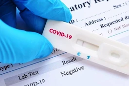 Bộ Y tế khẳng định đã có nhiều văn bản chỉ đạo về giá xét nghiệm nhanh kháng nguyên, Bộ dự kiến đề nghị đưa test xét nghiệm Covid-19 vào mặt hàng bình ổn giá, vì hiện nay mỗi nơi áp đặt một giá, khiến nhiều người băng khoăn.