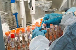 Xét nghiệm Covid-19