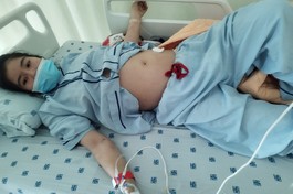 Mở rộng lòng từ: Giúp em Tâm Như chi phí điều trị bệnh lupus