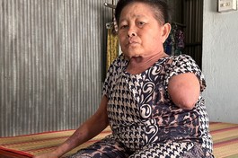 Mở rộng lòng từ: Bệnh tắc nghẽn mạch máu phải đoạn tay 