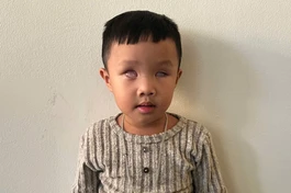 Mở rộng lòng từ: Bé bị ung thư mù hai mắt