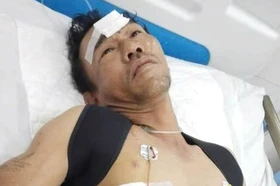 Mở rộng lòng từ: Xin mở lòng cứu người cha nghèo bị tai nạn