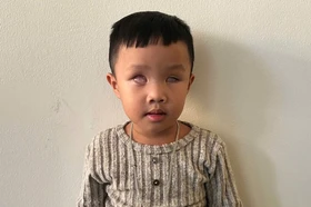 Mở rộng lòng từ: Bé bị ung thư mù hai mắt