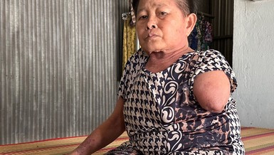 Mở rộng lòng từ: Bệnh tắc nghẽn mạch máu phải đoạn tay 