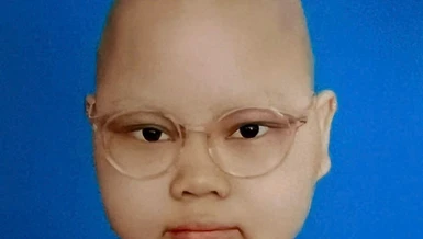 Mở rộng lòng từ: Nhà nghèo bị bệnh ung thư não