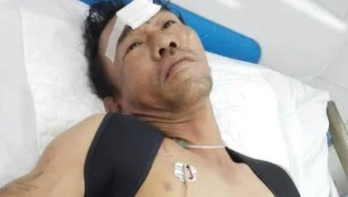 Mở rộng lòng từ: Xin mở lòng cứu người cha nghèo bị tai nạn