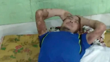 Mở rộng lòng từ: Người đàn ông mắc nhiều bệnh