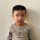 Mở rộng lòng từ: Bé bị ung thư mù hai mắt