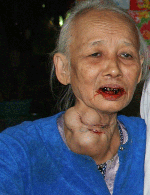 morong-1.gif