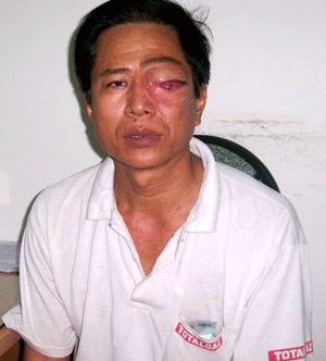 Hai bệnh dồn ở một người… ảnh 1 longtu.gif