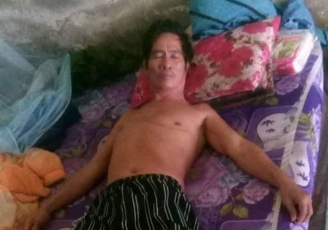 Ông Trần Minh Hùng bị di chứng từ tai nạn giao thông