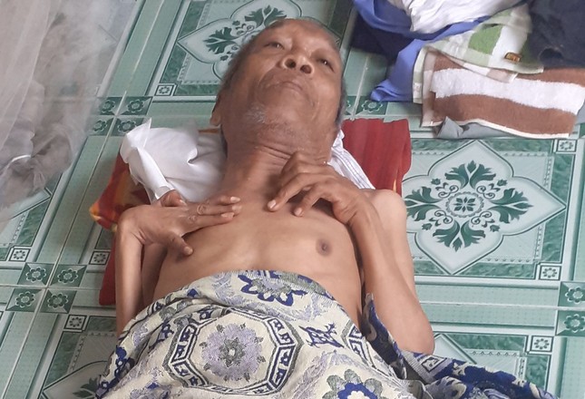 Ông Nguyễn Tấn Hoàng với đôi tay co quắp Ông Nguyễn Tấn Hoàng với đôi tay co quắp