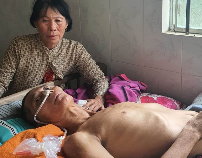 Ông Em lại bị tai biến, nằm liệt giường Ông Em lại bị tai biến, nằm liệt giường