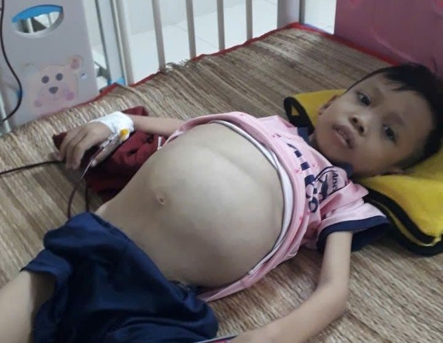 Cháu Thái Thành Nhân (10 tuổi) bị bệnh thiếu máu bẩm sinh thể nặng