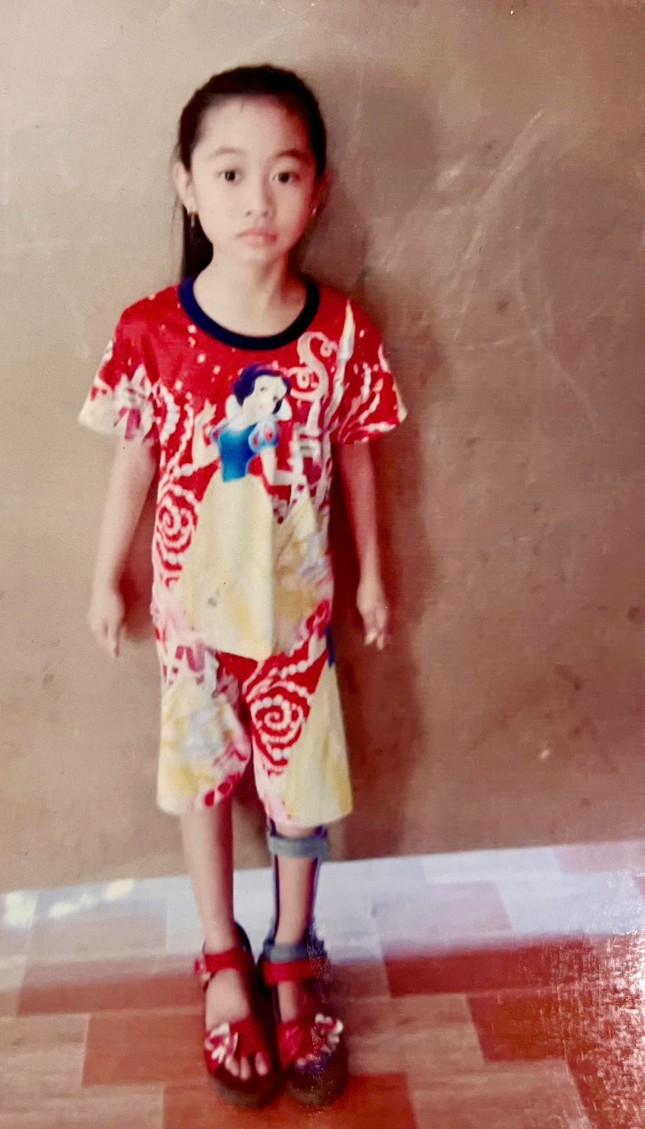 Em Thư không may bị tật vận động và tim bẩm sinh