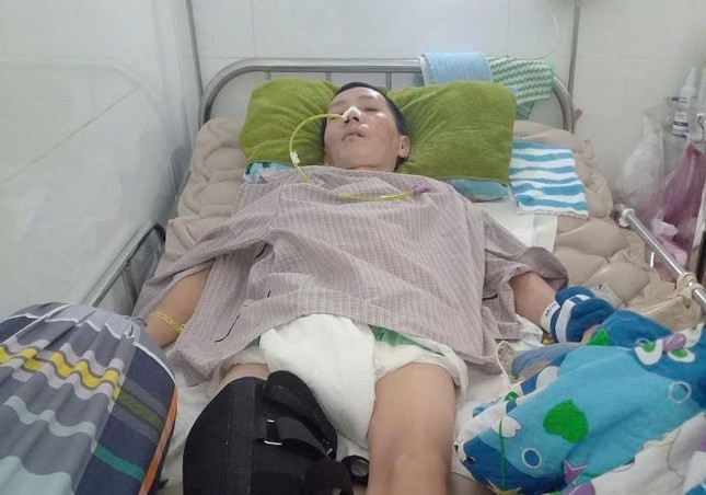 Tai nạn đã khiến anh Nghiêm bị xuất huyết hai bán cầu não Tai nạn đã khiến anh Nghiêm bị xuất huyết hai bán cầu não