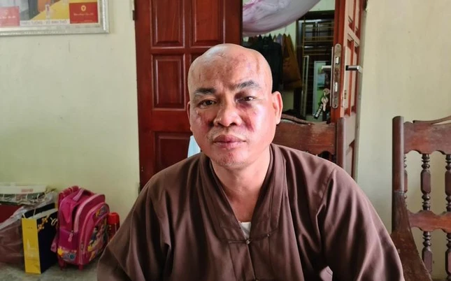 Đại đức Thích Nhẫn Kiên bị hành hung gây chấn thương