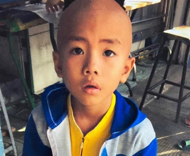 Cháu Kiệt bị bệnh ung thư não