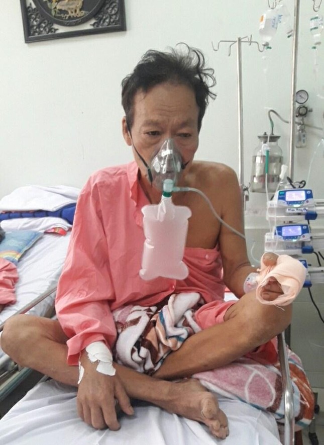 Ông Nguyễn Văn Thảo bị nhồi máu cơ tim