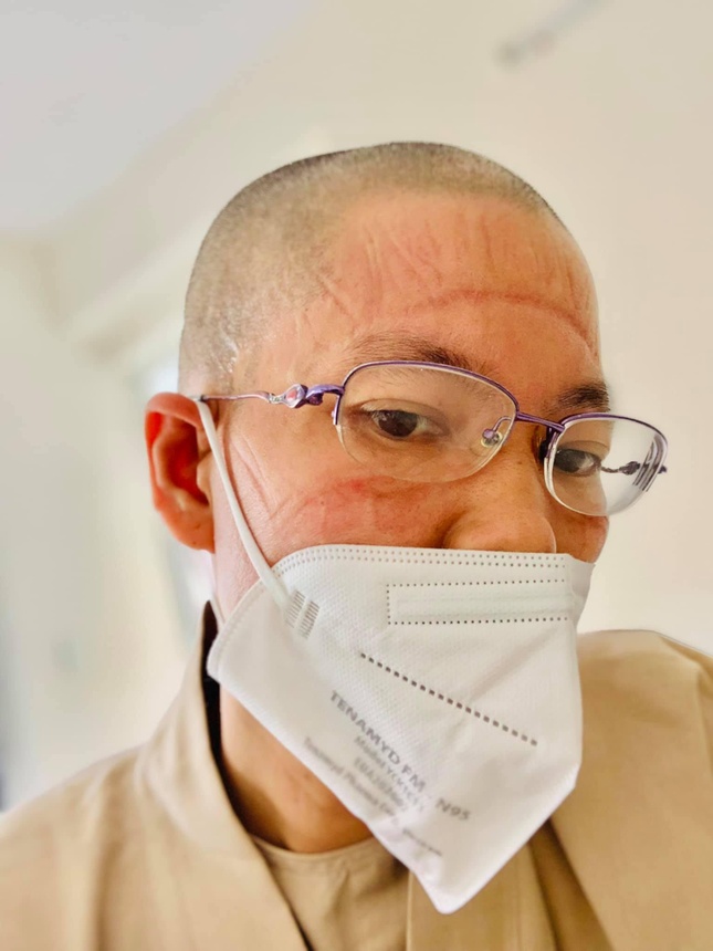 Những vết hằn sau nhiều giờ mặc đồ bảo hộ Những vết hằn sau nhiều giờ mặc đồ bảo hộ