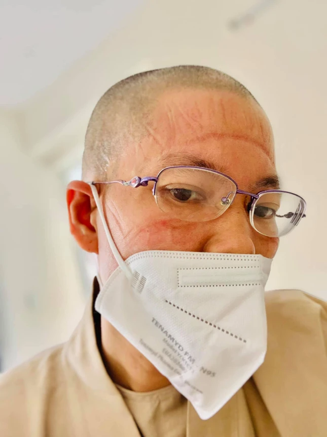 Những vết hằn sau nhiều giờ mặc đồ bảo hộ Những vết hằn sau nhiều giờ mặc đồ bảo hộ