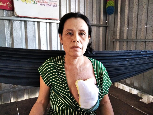 Bà Dung bị bướu ác tính, không tiền điều trị