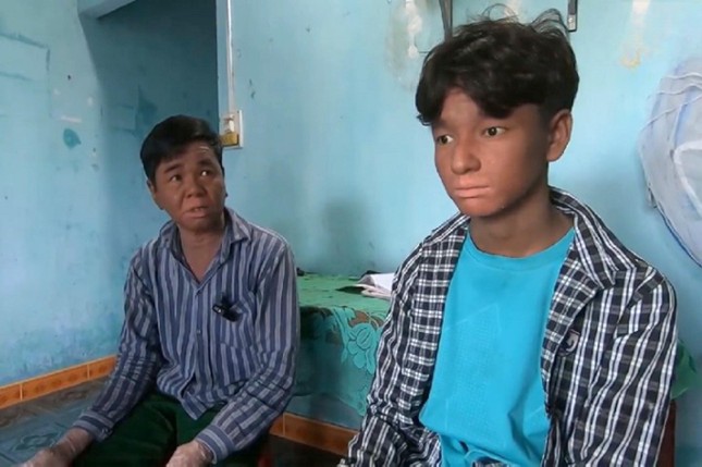 Cha con ông Nhi sống nhờ vào số tiền trợ cấp người nghèo hằng tháng và thỉnh thoảng nhận quà từ các hội từ thiện Cha con ông Nhi sống nhờ vào số tiền trợ cấp người nghèo hằng tháng và thỉnh thoảng nhận quà từ các hội từ thiện