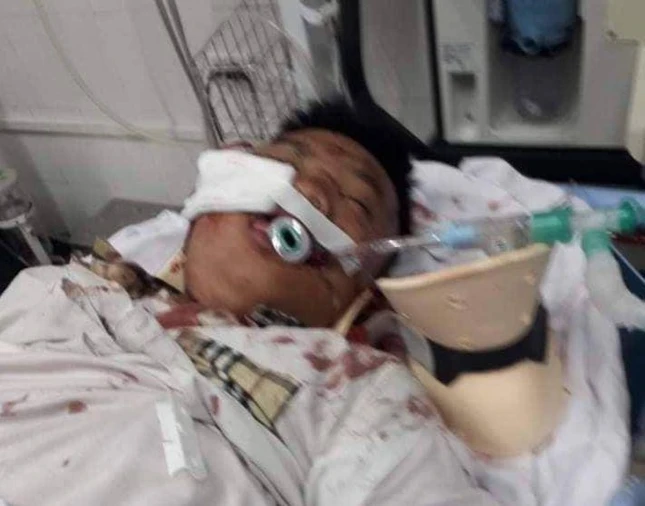 Em Tài đã bị tai nạn giao thông