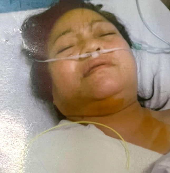 Chị Đào Thị Thanh bị suy tim, tai biến mạch máu não