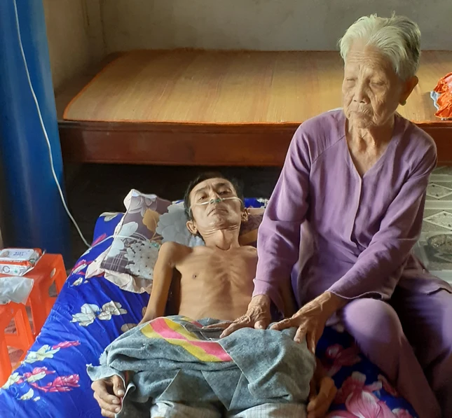 Anh Nhung nằm còng queo, phải thở máy mỗi ngày trong sự tuyệt vọng.