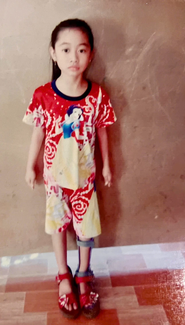 Em Thư không may bị tật vận động và tim bẩm sinh