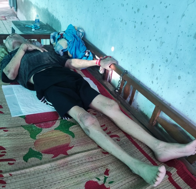 Ông Hưng bị tai biến phải nằm liệt giường