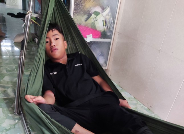 Cháu Duy mắc bệnh động kinh, di chứng chấn thương sọ não, liệt vận nhãn trong bên phải