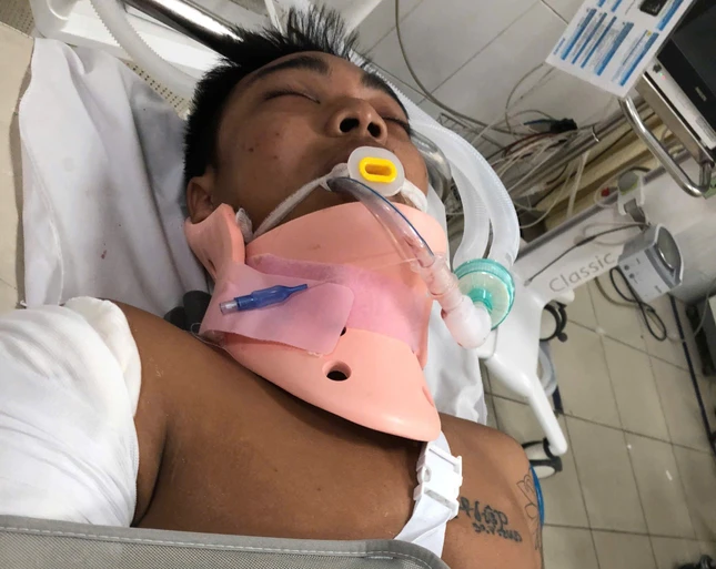 Em Hiệp không may bị tai nạn giao thông