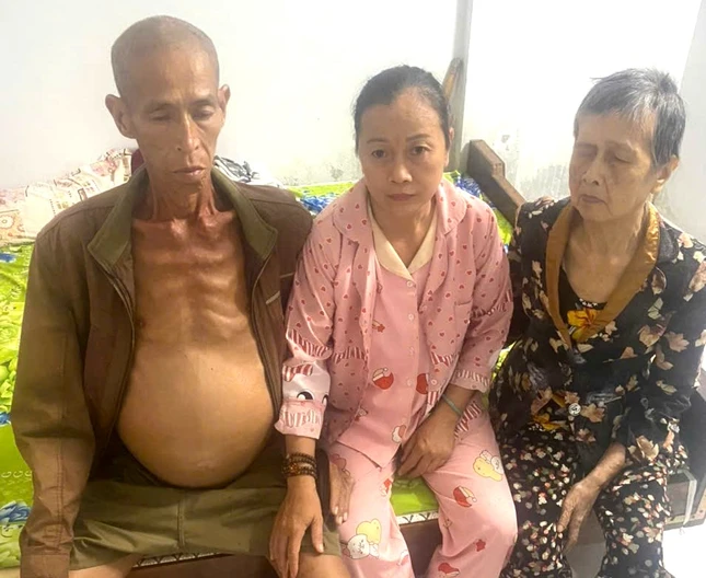 Cả hai vợ chồng bị ung thư Cả hai vợ chồng bị ung thư