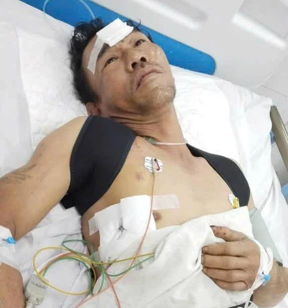 Anh Ngô Xuân Hòa bị tai nạn giao thông