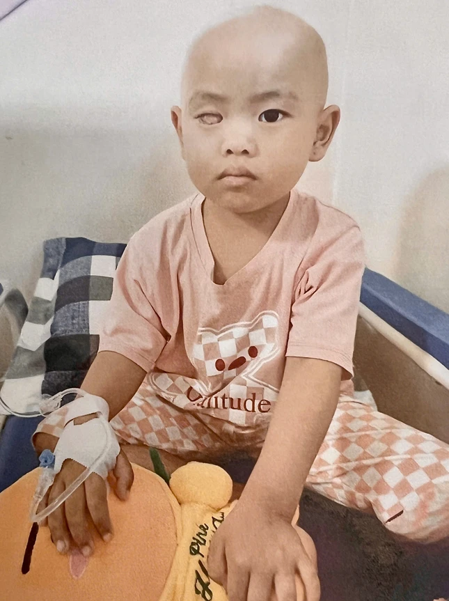 Cháu Duyên đang điều trị hóa trị tại Bệnh viện Ung Bướu Cháu Duyên đang điều trị hóa trị tại Bệnh viện Ung Bướu