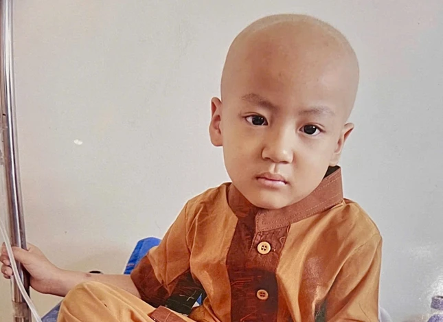 Cháu Nguyễn Phạm Bảo Kiên mắc bệnh bạch cầu cấp Cháu Nguyễn Phạm Bảo Kiên mắc bệnh bạch cầu cấp