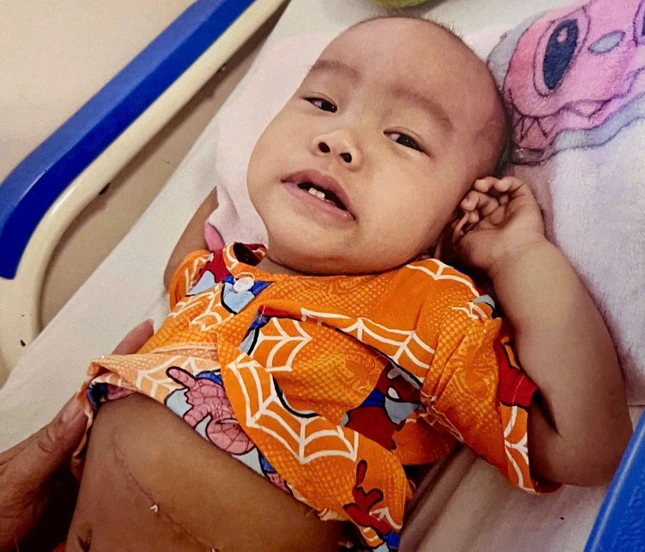 Cháu Tuấn Kiệt mắc u tăng sinh không xác định Cháu Tuấn Kiệt mắc u tăng sinh không xác định
