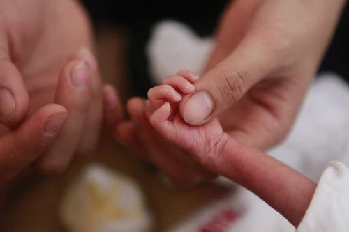 98 đứa trẻ và 25 cô bảo mẫu sống... ...trong 7 căn phòng chật hẹp Giấc ngủ hồn nhiên Đứa trẻ bị tật bẩm sinh được nhà chùa đưa đi phẫu thuật Bé sơ sinh hơn 10 ngày tuổi bị vứt bỏ trước cổng chùa Bàn tay nhỏ xíu bằng một ngón tay của cô bảo mẫu