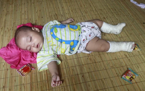 98 đứa trẻ và 25 cô bảo mẫu sống... ...trong 7 căn phòng chật hẹp Giấc ngủ hồn nhiên Đứa trẻ bị tật bẩm sinh được nhà chùa đưa đi phẫu thuật Bé sơ sinh hơn 10 ngày tuổi bị vứt bỏ trước cổng chùa Bàn tay nhỏ xíu bằng một ngón tay của cô bảo mẫu