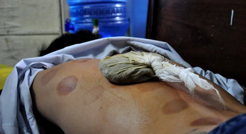 Việc đầu tiền của người bệnh khi đến khám là lấy số thứ tự sau đó ngồi chờ đến lượt được gọi vào khám. Nhà sư thăm hỏi tình hình bệnh rồi chẩn đoán để đưa ra hướng chữa trị. Những trường hợp bị bong gân, sái khớp sẽ được nắn lại sau đó cho đắp thuốc. Những trường hợp khó, bệnh nhân thậm chí phải đi chụp phim rồi đưa về cho lương y xem để quyết định cách chữa trị. Những vị trí xương quá khó vượt ngoài tầm chữa trị của nơi đây, bệnh nhân sẽ được hướng dẫn vào bệnh viện. Việc băng bó thuốc được thực hiện tại chỗ. Bệnh nhân về nhà sau khi nhận lịch tái khám. Hòa thượng Thích Thanh Sơn trực tiếp khám cho các bệnh nhân. Các loại thuốc dùng để trị bệnh vốn là thảo dược được chính nhà chùa gửi trồng ở Bình Dương, Lâm Đồng. Thuốc được pha chế theo công thức y học cổ truyền. Cả người nước ngoài cũng đến điều trị tại đây. Do khám chữa miễn phí nên số người đến khám luôn đông.