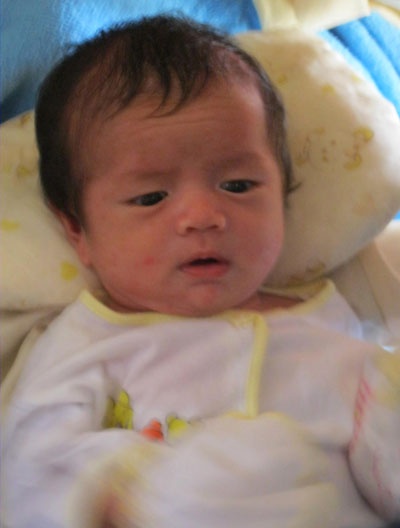 Bé trai được đặt pháp danh Huệ Phúc có dị tật ở chân cần được phẫu thuật sớm.