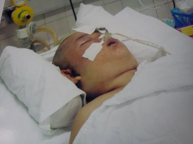 Mo rong long tu, Cai eo cua mot gia dinh ngheoLDL.jpg