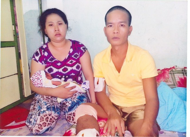 Giúp anh Thạch Von chi phí phẫu thuật ảnh 1 MRLT.jpg