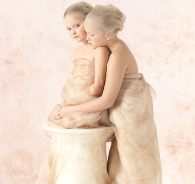 Những bức ảnh chấn động về trẻ bị viêm màng não ảnh 2 Anh 2 .jpg