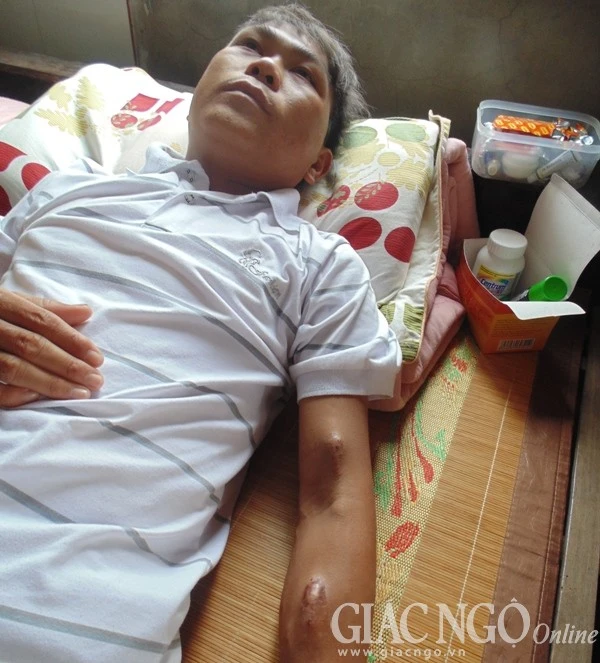 Chàng trai suy thận đếm sống từng ngày ảnh 1 anh MRLT, Tran Xuan Sang.JPG